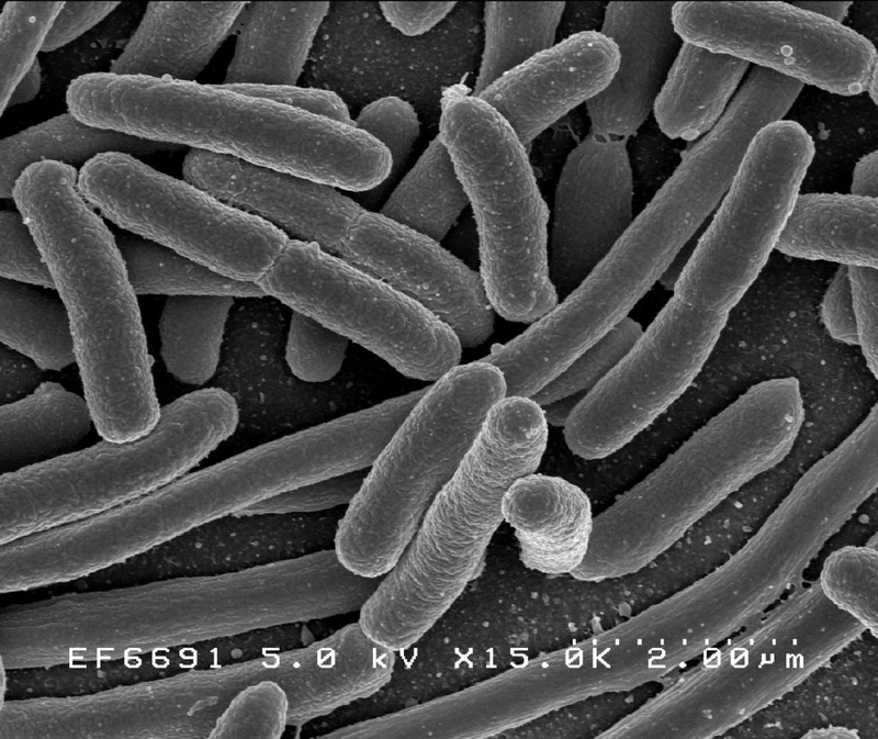 Escherichia coli vista al microscopio. Foto: Wikimedia Commons.